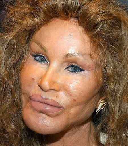 awful plastic surgery. morning when I have